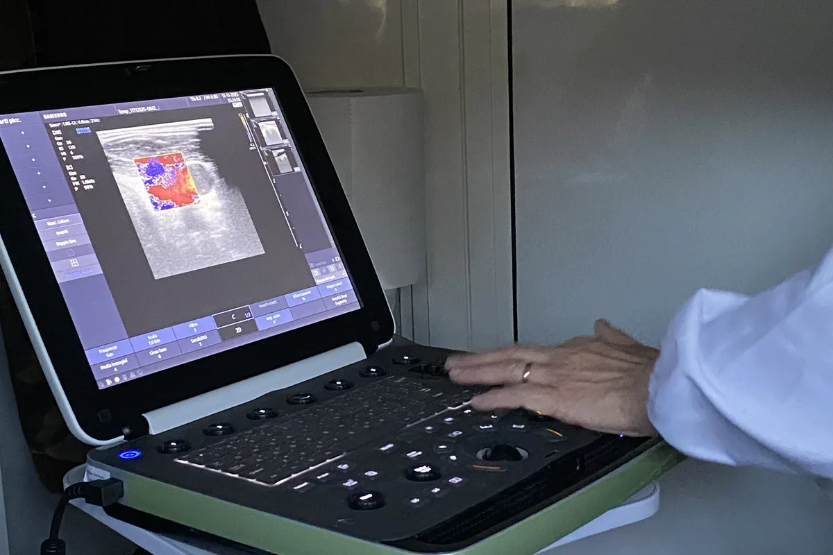 Ecografia tiroidea sul monitor diagnostico dell'ambulatorio mobile