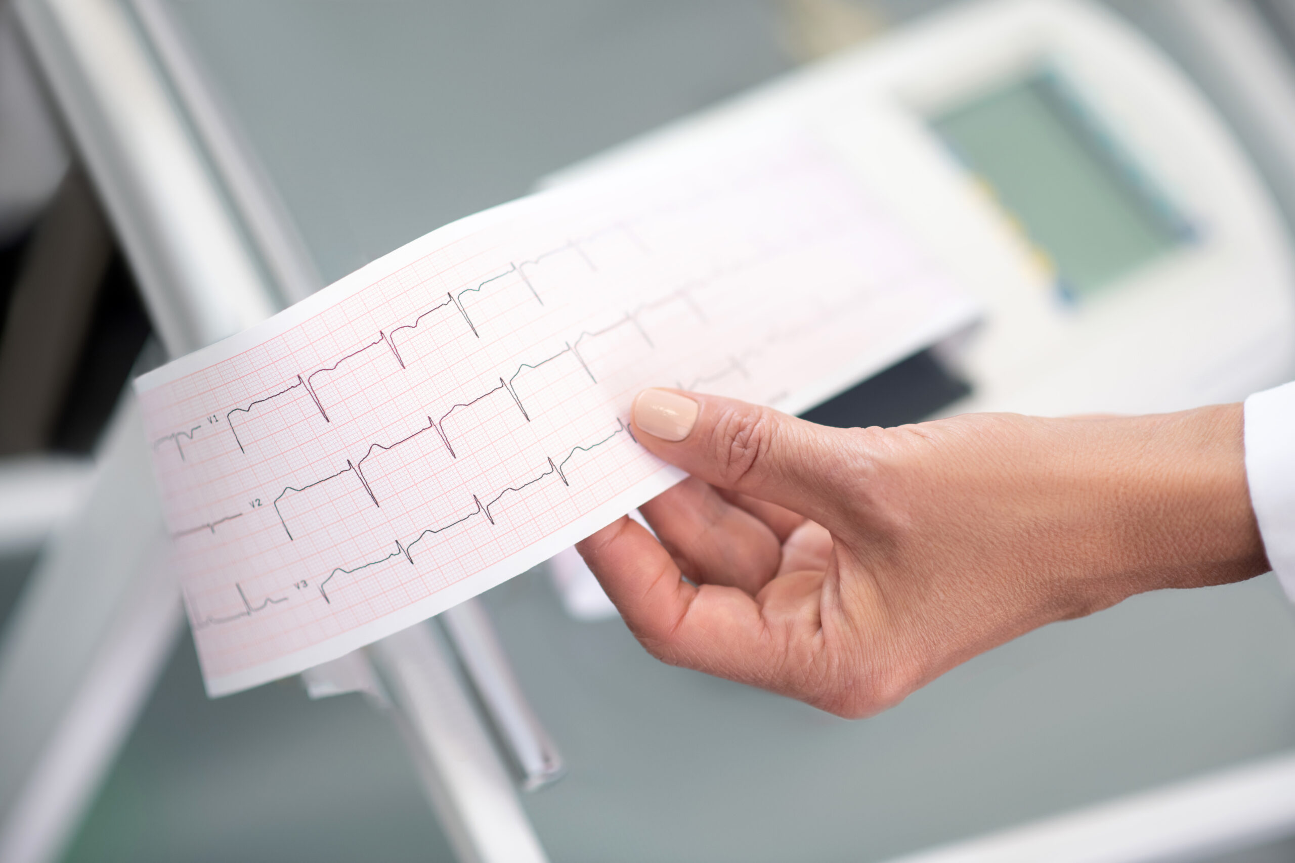 Close up of doctors hand with electrocardigram result