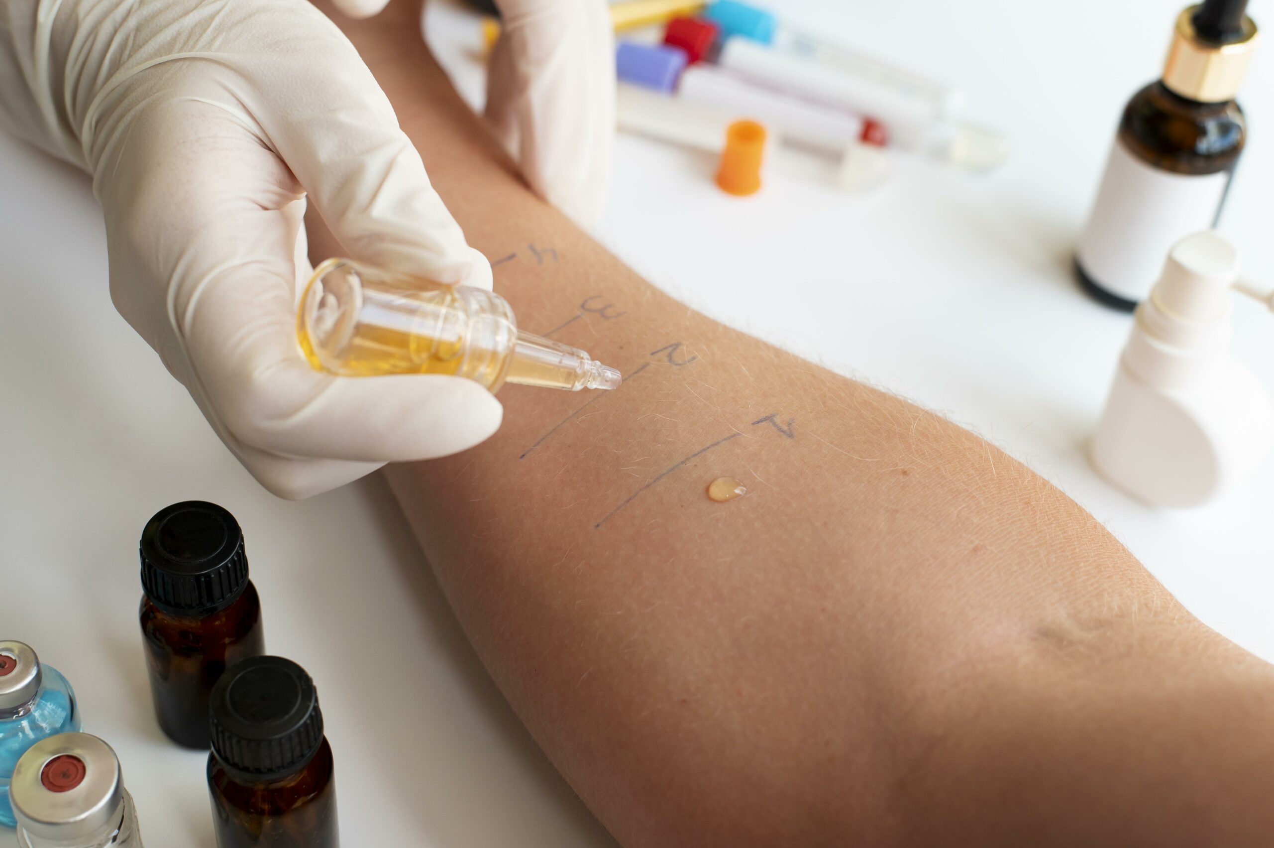 skin-allergy-reaction-test-person-s-arm