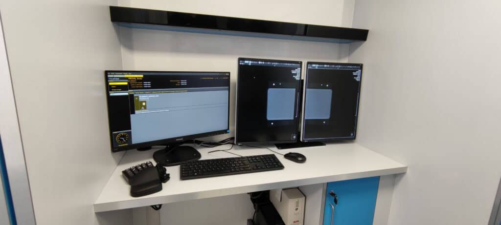 Postazione di refertazione digitale all'interno della Clinica Mobile, con monitor ad alta risoluzione per l'analisi di mammografie ed ecografie.